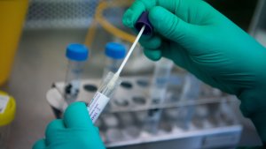 За сутки выявлено 175 новых случаев коронавируса