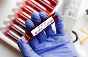Зарегистрирован 241 новый случай коронавируса, выздоровело 197 пациентов